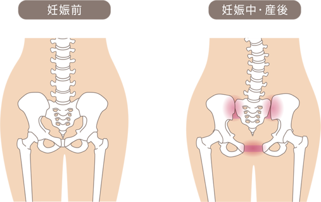 骨盤の状態